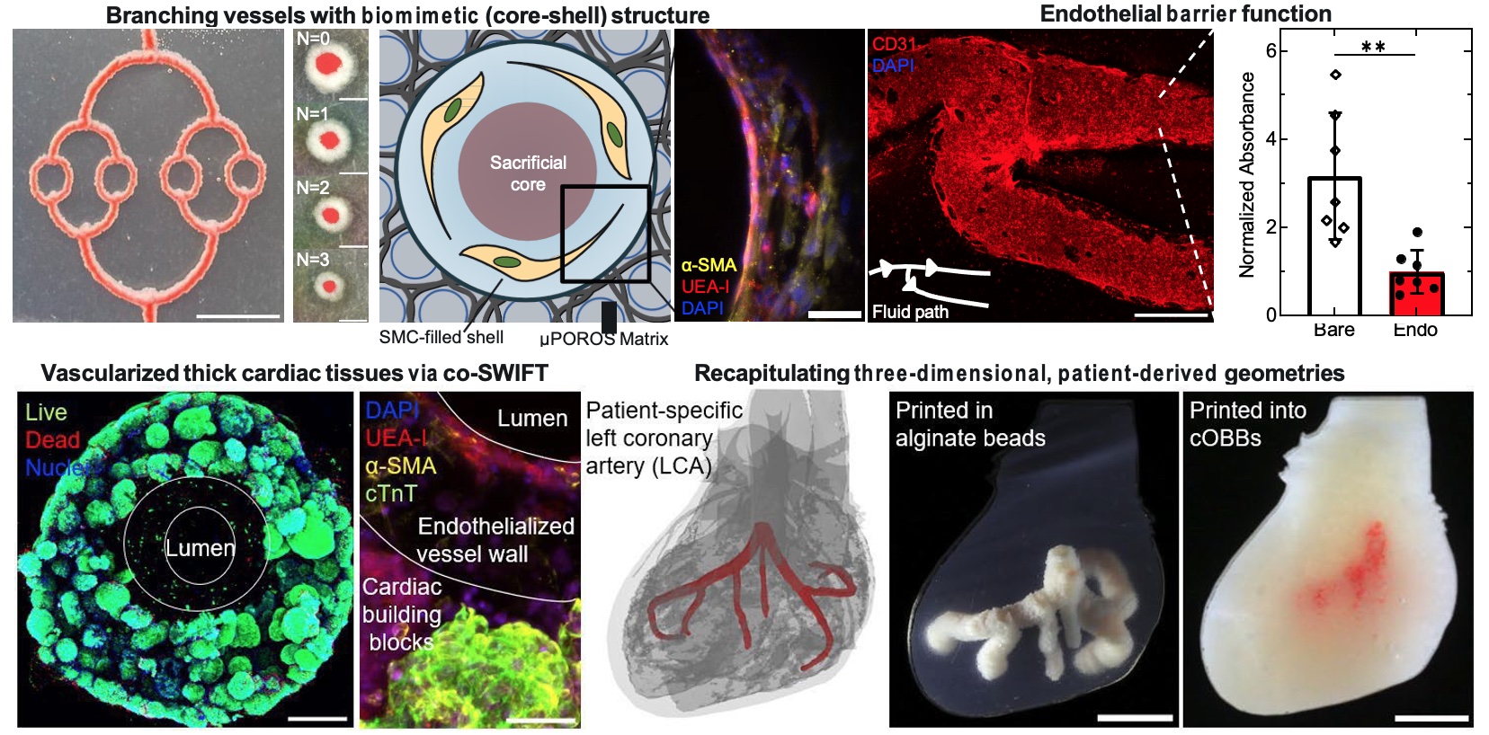 Using co-SWIFT, researchers at NSF CELL-MET demonstrated vascularized biomimetic cardiac tissues with three-dimensional, patient-derived geometries 