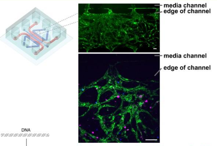 OMI reveals a bone-marrow chip created by CMaT researchers. The chip contains a permeable vascular network of endothelial cells (green; top) with an editable co-culture network of primary multiple mye